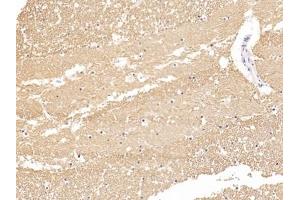 Immunohistochemistry (IHC) image for anti-Tubulin, beta (TUBB) (AA 170-419) antibody (ABIN7443818)