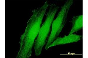 Immunofluorescence of purified MaxPab antibody to EXOSC1 on HeLa cell. (EXOSC1 抗体  (AA 1-195))