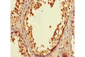 Immunohistochemistry of paraffin-embedded human testis tissue using ABIN7176179 at dilution of 1:100 (ZNF23 抗体  (AA 201-474))