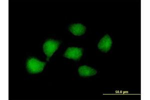 Immunofluorescence of purified MaxPab antibody to KLF8 on HeLa cell. (KLF8 抗体  (AA 1-359))