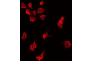 ABIN6274848 staining HeLa by IF/ICC. (AIG1 抗体  (C-Term))