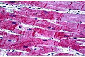 Human Heart: Formalin-Fixed, Paraffin-Embedded (FFPE) (HSPB8 抗体  (AA 97-197))