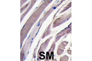 Formalin-fixed and paraffin-embedded human skeletal muscle tissue reacted with HK2 polyclonal antibody  , which was peroxidase-conjugated to the secondary antibody, followed by DAB staining. (Hexokinase 2 抗体  (N-Term))