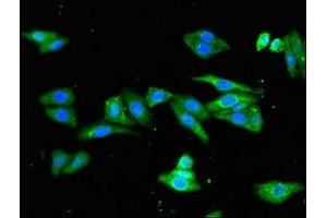 Immunofluorescent analysis of HepG2 cells using ABIN7163820 at dilution of 1:100 and Alexa Fluor 488-congugated AffiniPure Goat Anti-Rabbit IgG(H+L) (PKD1L1 抗体  (AA 921-1164))