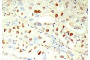 Immunohistochemistry (IHC) image for anti-Cyclin E1 (CCNE1) antibody (ABIN567783) (Cyclin E1 抗体)