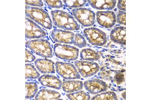 Immunohistochemistry of paraffin-embedded mouse Intestine using BMPR1B antibody (ABIN5971046) at dilution of 1/200 (40x lens). (BMPR1B 抗体)