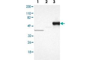 Western blot anyalysis of Lane 1: Human cell line RT-4, Lane 2: Human cell line U-251MG sp, Lane 3: Human plasma (IgG/HSA depleted) with SERPINA7 polyclonal antibody . (SERPINA7 抗体)