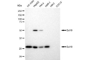 Western blotting analysis using Bcl10 antibody (ABIN7797716). (Recombinant BCL10 抗体)