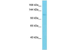 Western Blotting (WB) image for anti-ArfGAP with SH3 Domain, Ankyrin Repeat and PH Domain 2 (ASAP2) (N-Term) antibody (ABIN2790909)