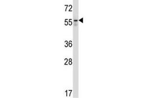Western Blotting (WB) image for anti-Beclin 1, Autophagy Related (BECN1) (AA 52-78) antibody (ABIN3029689)