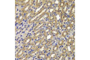 Immunohistochemistry of paraffin-embedded mouse kidney using CCNA2 antibody at dilution of 1:100 (x400 lens). (Cyclin A 抗体)