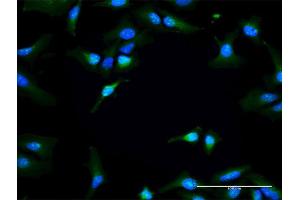Immunofluorescence of purified MaxPab antibody to RAPGEF3 on HeLa cell. (RAPGEF3 抗体  (AA 1-881))