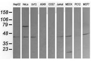 Image no. 6 for anti-Mitogen-Activated Protein Kinase Kinase 1 (MAP2K1) antibody (ABIN1499391) (MEK1 抗体)