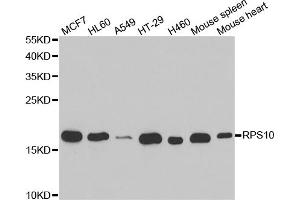Western blot analysis of extracts of various cell lines, using RPS10 antibody (ABIN5973486) at 1/1000 dilution. (RPS10 抗体)