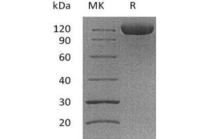 Western Blotting (WB) image for CD276 (CD276) protein (Fc Tag) (ABIN7320967) (CD276 Protein (CD276) (Fc Tag))