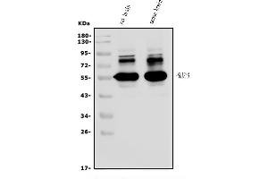 Western blot analysis of SHISA6 using anti-SHISA6 antibody (ABIN7600931).