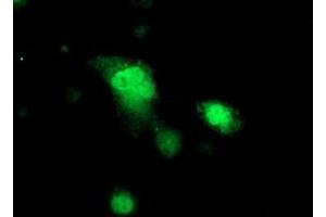 Immunofluorescence (IF) image for anti-Protein Kinase, CAMP-Dependent, Regulatory, Type I, beta (PRKAR1B) antibody (ABIN1500408) (PRKAR1B 抗体)