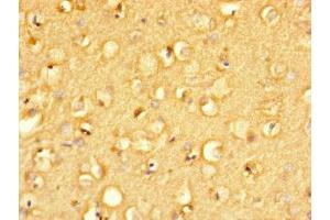 Immunohistochemistry of paraffin-embedded human brain tissue using ABIN7165793 at dilution of 1:100 (MANBAL 抗体  (AA 45-85))