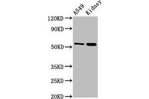 Western Blot Positive WB detected in: A549 whole cell lysate, Rat kidney tissue All lanes: AFG1L antibody at 3 μg/mL Secondary Goat polyclonal to rabbit IgG at 1/50000 dilution Predicted band size: 55 kDa Observed band size: 55 kDa (AFG1-Like ATPase (AFG1L) (AA 14-313) 抗体)