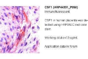 Image no. 2 for anti-Colony Stimulating Factor 1 (Macrophage) (CSF1) (Middle Region) antibody (ABIN2781824) (M-CSF/CSF1 抗体  (Middle Region))