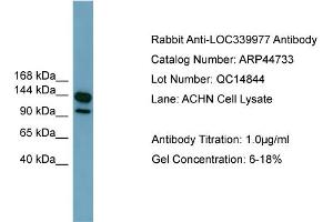 WB Suggested Anti-LRRC66  Antibody Titration: 0. (LRRC66 抗体  (Middle Region))