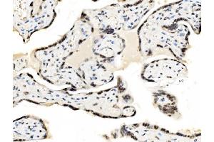 IHC analysis of JUNB using anti-JUNB antibody (ABIN7603223). (JunB 抗体  (N-Term))