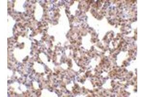 Immunohistochemistry of TRPC6 in mouse lung tissue with this product at 10 μg/ml. (TRPC6 抗体  (C-Term))
