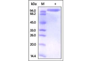 SDS-PAGE (SDS) image for Dipeptidyl-Peptidase 4 (DPP4) (AA 29-766) protein (ABIN2180980) (DPP4 Protein (AA 29-766))