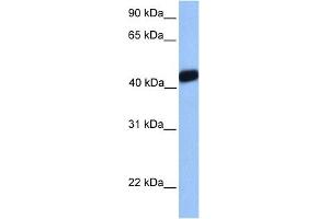 Western Blotting (WB) image for anti-LIM Homeobox Transcription Factor 1, alpha (LMX1A) (Middle Region) antibody (ABIN2779408)
