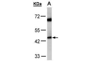WB Image Sample(30 μg of whole cell lysate) A:HeLa S3, 10% SDS PAGE antibody diluted at 1:1000 (Medium-Chain Specific Acyl-CoA Dehydrogenase, Mitochondrial (C-Term) 抗体)