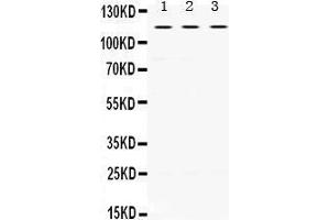 Western Blotting (WB) image for anti-Unc-5 Homolog C (C. Elegans) (Unc5c) (AA 894-930), (C-Term) antibody (ABIN3042323)