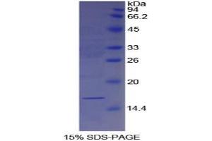SDS-PAGE analysis of Human Galectin 7 Protein. (LGALS7 蛋白)