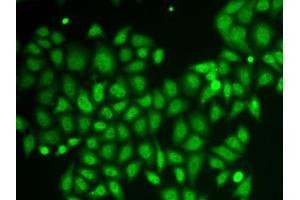 Immunofluorescence analysis of HeLa cells using AKR1A1 antibody. (AKR1A1 抗体  (AA 1-325))