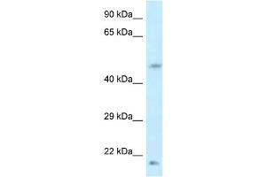 WB Suggested Anti-LOC100360413 Antibody   Titration: 1. (LOC100360413 抗体  (Middle Region))