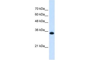 Western Blotting (WB) image for anti-Solute Carrier Family 25, Member 38 (SLC25A38) antibody (ABIN2462759) (SLC25A38 抗体)