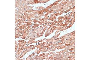 Immunohistochemistry of paraffin-embedded mouse heart using TMX1 antibody  at dilution of 1:100 (40x lens). (TMX1 抗体  (AA 210-280))