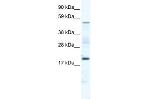 WB Suggested Anti-CSNK1G1 Antibody Titration:  5. (CSNK1G1 抗体  (Middle Region))