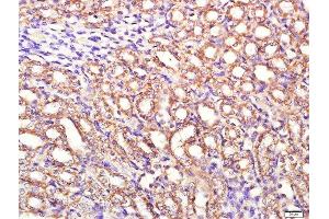 Paraformaldehyde-fixed, paraffin embedded rat kidney tissue, Antigen retrieval by boiling in sodium citrate buffer(pH6) for 15min, Block endogenous peroxidase by 3% hydrogen peroxide for 30 minutes, Blocking buffer (normal goat serum) at 37°C for 20min, Antibody incubation with Rabbit Anti-PI3KCA Polyclonal Antibody, Unconjugated  at 1:400 overnight at 4°C, followed by a conjugated secondary and DAB staining (PIK3CA 抗体  (AA 961-1068))