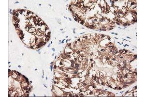 Image no. 2 for anti-UDP-Galactose-4-Epimerase (GALE) antibody (ABIN1498366) (GALE 抗体)