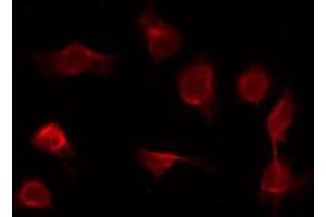 ABIN6267421 staining COS7 by IF/ICC. (Phospholipase C gamma 1 抗体  (pTyr783))