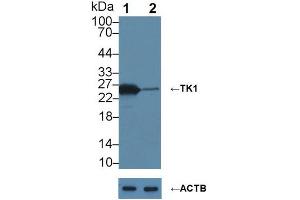 Knockout Varification: ;Lane 1: Wild-type MCF7 cell lysate; ;Lane 2: TK1 knockout MCF7 cell lysate; ;Predicted MW: 25kDa ;Observed MW: 25kDa;Primary Ab: 6µg/ml Mouse Anti-Human TK1 Antibody;Second Ab: 0. (TK1 抗体  (AA 2-234))