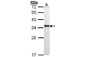 WB Image Sample (30 ug of whole cell lysate) A: H1299 12% SDS PAGE antibody diluted at 1:1000 (HLA-DRA 抗体)