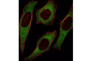 Immunofluorescence (IF) image for anti-Insulin Receptor Substrate 2 (IRS2) antibody (ABIN3003492) (IRS2 抗体)