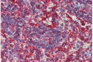 Immunohistochemistry (Formalin-fixed Paraffin-embedded Sections) (IHC (fp)) image for anti-Cytochrome P450, Family 11, Subfamily A, Polypeptide 1 (CYP11A1) (AA 288-337) antibody (ABIN6744438)