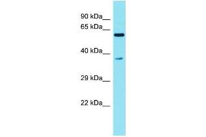 Host: Rabbit Target Name: C3orf30 Sample Type: Fetal Liver lysates Antibody Dilution: 1. (C3orf30 抗体  (N-Term))