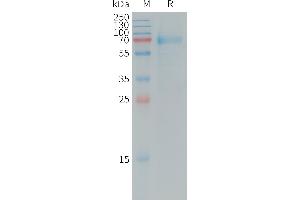 Human IL20RA Protein, hFc Tag on SDS-PAGE under reducing condition.