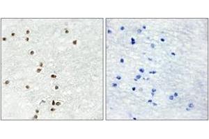 Immunohistochemistry analysis of paraffin-embedded human brain tissue, using ZIC1/2/3 Antibody. (ZIC1/2/3 抗体  (AA 316-365))
