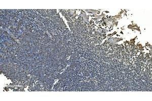 IHC analysis of LSM8 using anti-LSM8 antibody (ABIN7599579). (NAA38 抗体  (AA 1-96))