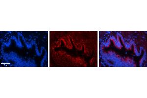 Rabbit Anti-UQCR10 Antibody     Formalin Fixed Paraffin Embedded Tissue: Human Bronchial Epithelial Tissue  Observed Staining: Cytoplasmic  Primary Antibody Concentration: 1:100  Other Working Concentrations: 1/600  Secondary Antibody: Donkey anti-Rabbit-Cy3  Secondary Antibody Concentration: 1:200  Magnification: 20X  Exposure Time: 0. (UQCR10 抗体  (Middle Region))