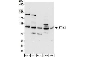 anti-Stromal Interaction Molecule 2 (Stim2) (AA 650-700) antibody